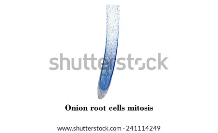 Light photomicrograph of Mitosis of onion root tip cells seen through microscope