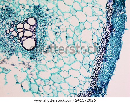 Light photomicrograph of Cucurbita stem cross section seen through microscope