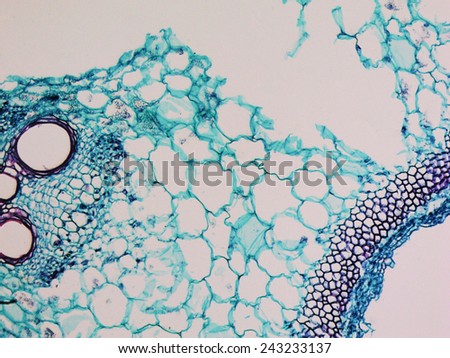 Light photomicrograph of Cucurbita stem cross section seen through microscope
