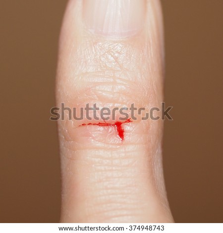 Paper Cut Caused By A Thin Sharp Piece Of Paper Slicing The Skin Stock ...