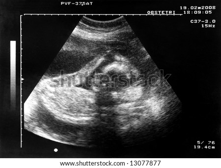 Baby Inside The Belly Of Her Mother Stock Photo 13077877 : Shutterstock