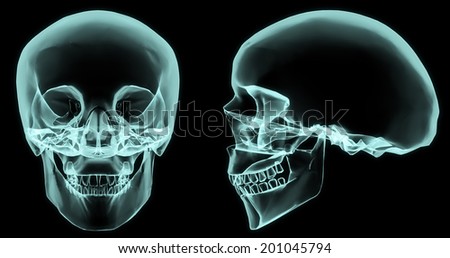 X-ray front and side skull in brightness blue with black background