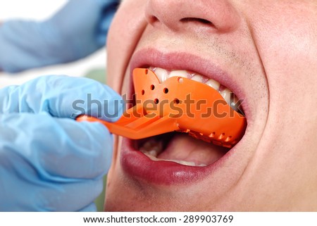 dentist inserts blade into patient\'s mouth for impression taking
