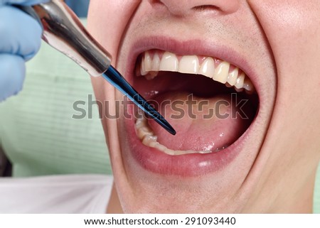 dentist examines the patient\'s mouth, close up