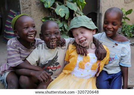 UKEREWE - TANZANIA - JULY 2, 2015: Unidentified albino child and boys on July 2, 2015 in Ukerewe, Tanzania. Many traditional healers have been arrested recently in Tanzania because of albino murders