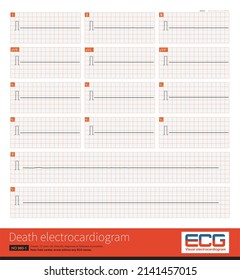 A 33 Year Old Female Was Diagnosed With Fulminant Myocarditis. Refractory Ventricular Arrhythmia Occurred Repeatedly During Hospitalization And Finally Died.