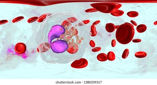 360degree Spherical Panorama Blood Eosinophilia Showing Stock ...