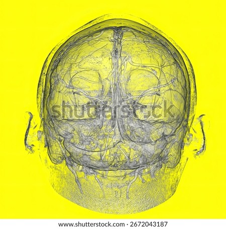3D CT Angiography of Circle of Willis and Human Brain Vessels Anatomy