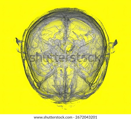 3D CT Angiography of Circle of Willis and Human Brain Vessels Anatomy