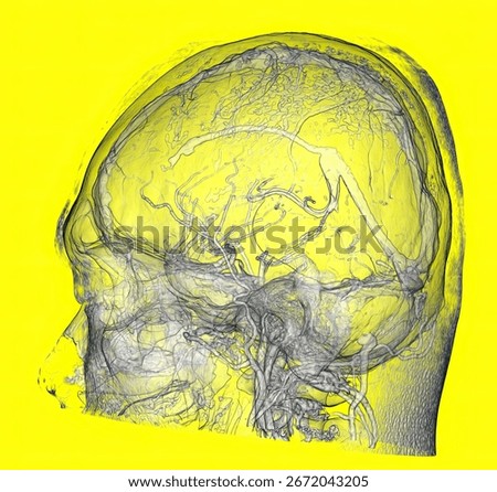 3D CT Angiography of Circle of Willis and Human Brain Vessels Anatomy