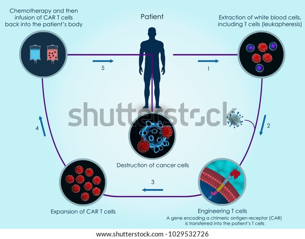 3d illustration of the basic steps of CAR T-cell\
therapy against\
cancer