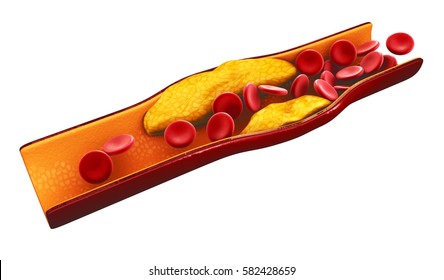 3d Illustration of blood cells with plaque buildup of cholesterol isolated white