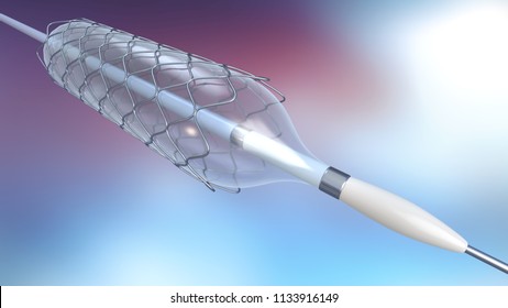3d illustration of catheter for stent implantation for supporting blood circulation into blood vessels