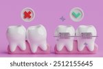 3D illustration of crooked teeth and teeth with braces