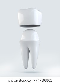 3D Illustration Of Crown Tooth On White, Dental Concept.