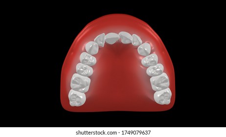 3d Illustration Of A Dental Arch In Disharmony