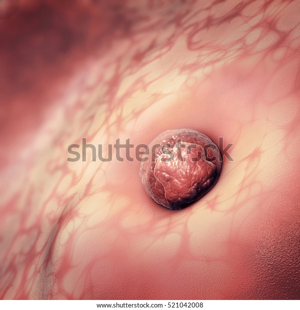 3D Illustration of an egg cell or ovum sticking to\
the uterus