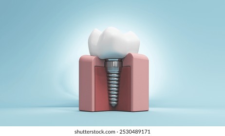 3D illustration features a molar tooth, highlighting its enamel and root structure. Implant image for dental, healthcare, and educational content focused on oral hygiene and treatment. - Powered by Shutterstock