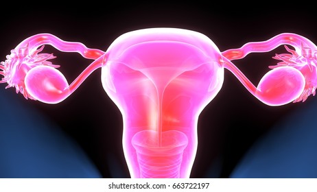 Polycystic Ovary Syndrome 3d Illustration Showing Stock Illustration ...