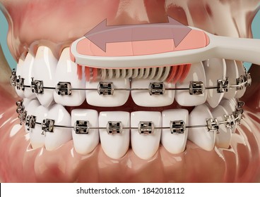 3D illustration Front ToothBrush above braces with arrow - Powered by Shutterstock