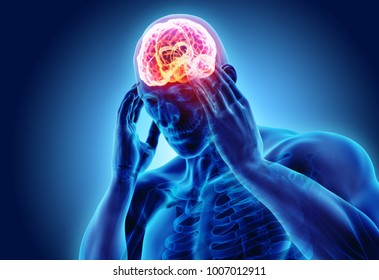 3d illustration of headache human, x-ray medical concept. - Powered by Shutterstock