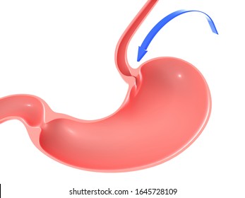 
3D Illustration Of The Human Stomach, Highlighting The Esophageal Sphincter. With A Blue Arrow With Movement, Pointing.