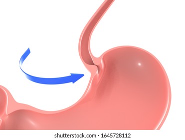 
3D Illustration Of The Human Stomach, Highlighting The Esophageal Sphincter. With A Blue Arrow With Movement, Pointing.