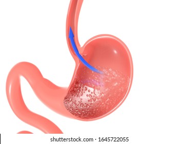 3D Illustration Of The Inside Of The Stomach Showing The Reflux Of Food. Through The Esophagus, With An Arrow Pointing To The Movement. Cropped Image Isolated On White Background.