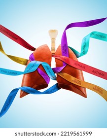 A 3D Illustration: Lungs Concept: Tying Lungs Problem Disease Asthma 
COPD, Cystic Fibrosis, Lung Cancer, Tuberculosis, Bronchitis, Pneumonia, Emphysema Most Common Types Of Respiratory Disease