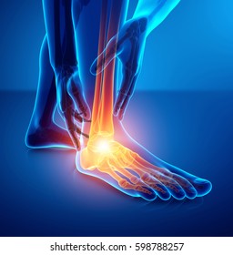 3d Illustration Of Male Foot With Ankle Pain