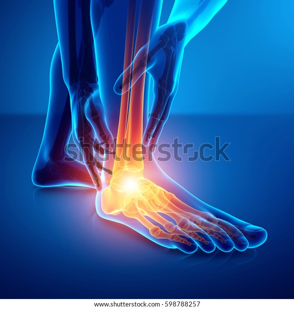 足首の痛みを持つ男性の足の3dイラスト のイラスト素材