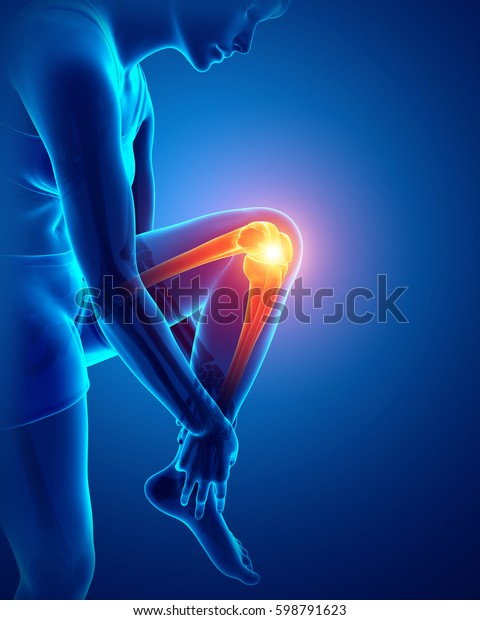 男性の膝の痛みの3dイラスト のイラスト素材