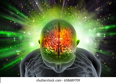 3d Illustration Of Man Suffering Migraine