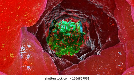 3d Illustration Of Mastocyte, Mast Cell, 3d Render