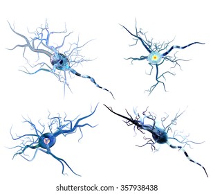 神経細胞の3dイラスト 神経疾患 腫瘍 脳手術のコンセプト のイラスト素材