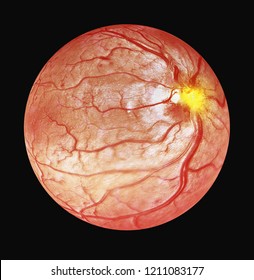 3d Illustration Of Optical Coherence Tomography OCT