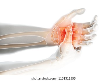 3d Illustration Palm Painful Skeleton Xray Stock Illustration ...