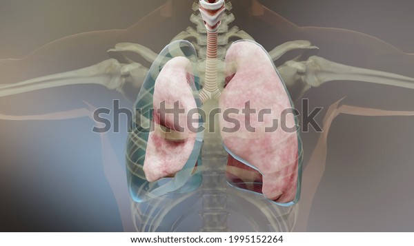 3d Illustration of Pneumothorax, Normal lung\
versus collapsed,  symptoms of pneumothorax, pleural effusion, \
empyema, complications after a chest injury, air in the pleural\
space, 3d Render