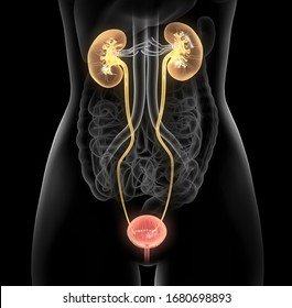 3D Illustration Showing Bladder Infection, Urinaty Tract Of A Woman,
