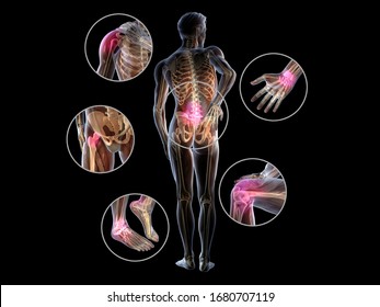 3D illustration showing painful joints of a man, rheumatoid arthritis