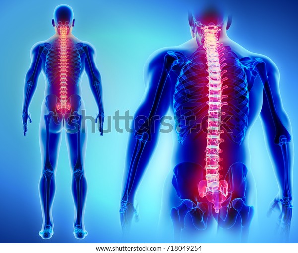3D\
illustration of Spine - Part of Human\
Skeleton.