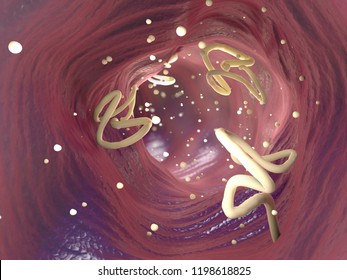 3d Illustration of tapeworm infestation in a human intestine
