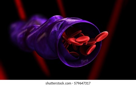 3d Illustration Of Varicose Vein Forms In A Leg, Isolated Black