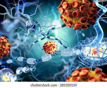 3d illustration of viruses attacking nerve cells, concept for Neurologic Diseases, tumors and brain surgery. 