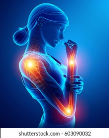3d Illustration of Women Feeling Arm joint pain