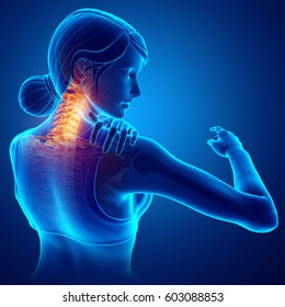 3d Illustration Women Feeling Neck Pain Stock Illustration 603088853 ...