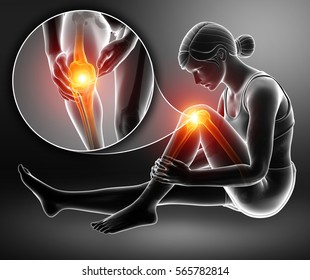 3d Illustration Of Women Knee Pain