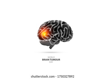 3d Illustration Of World Brain Tumour Concept. World Brain Tumour Day Is Observed On 8th Of June Every Year.