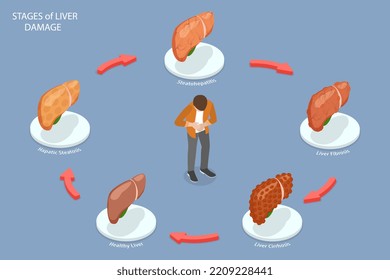 3D Isometric Flat  Conceptual Illustration Of Stages Of Liver Damage, Effect Of Poor Nutrition On Human Body