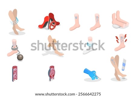 3D Isometric Flat  Set of Varicose Treatment, Health Care